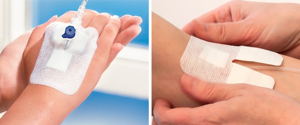 Fixing patch-bandage for catheters: features and advantages
