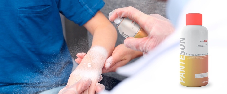Burn injuries: what is the first aid to the victim, what mistakes are often made