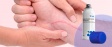  Профилактика образования рубцов на коже: какие меры не допустят их появления