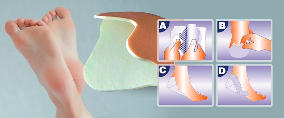 Non-adhesive polyurethane foam bandage