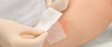 Wound dressings and band-aids for wound healing